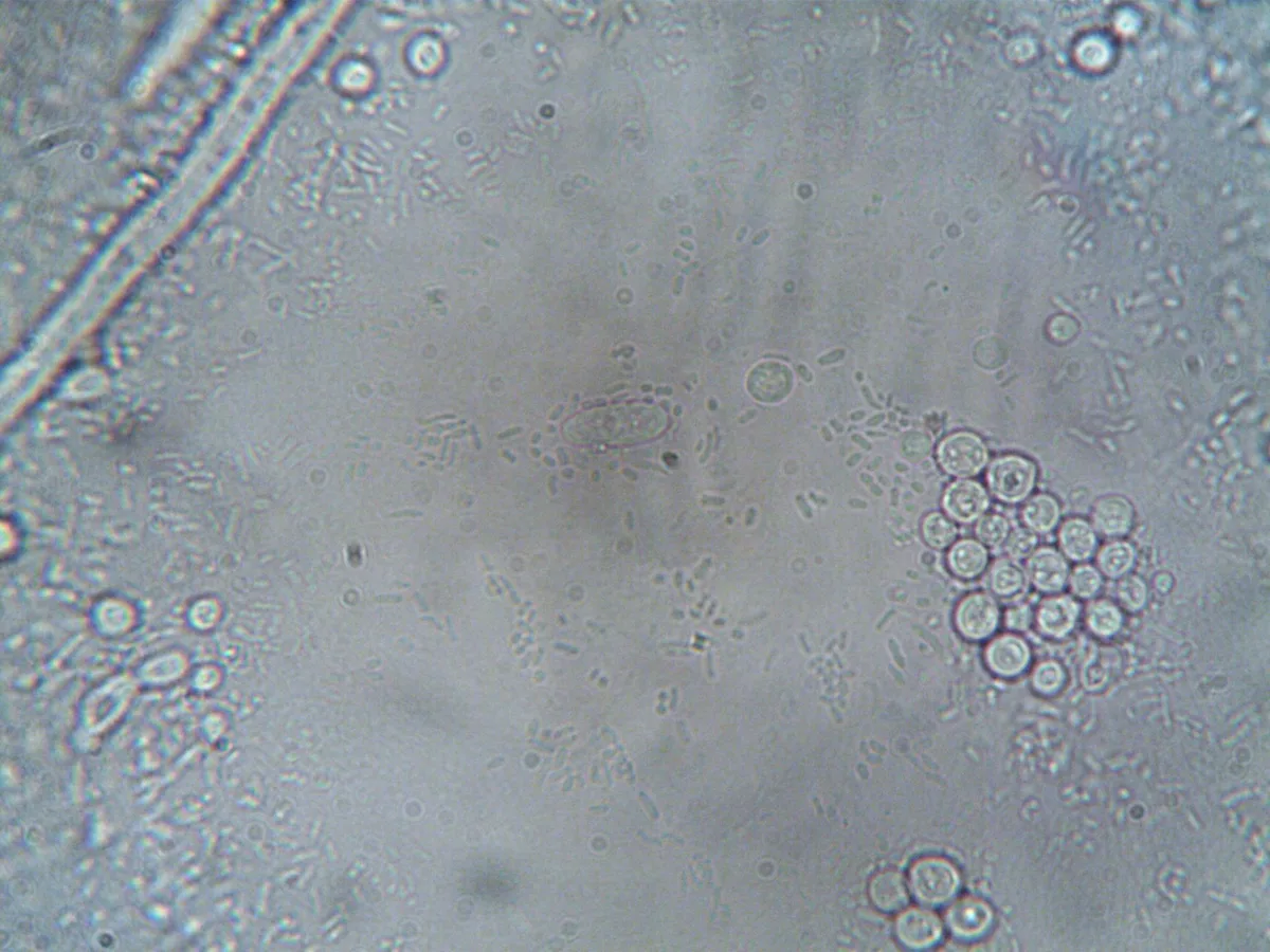 Analyse de cellules sanguines au microscope : globules rouges, blancs et plaquettes
