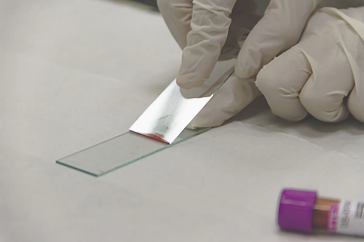 Vétérinaire effectuant un test sanguin pour diagnostiquer la dirofilariose canine