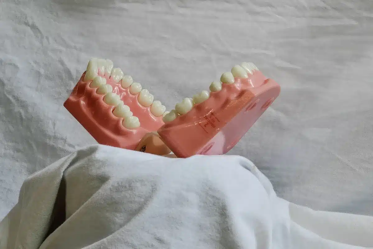 Vue rapprochée des dents d'un chien montrant dépôt de tartre le long de la gencive